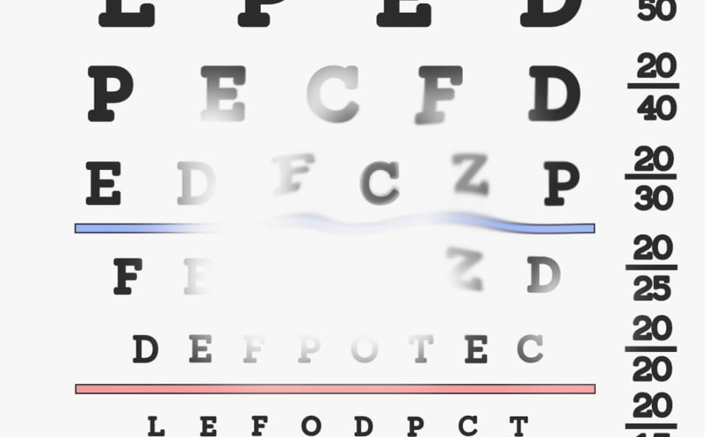 Image showing a blurry spot in the centre of the field of vision, demonstrating how GA may affect vision at diagnosis