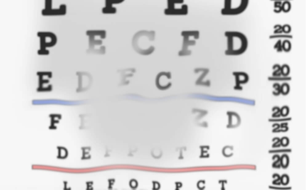 Image showing a blurry spot in the centre of the field of vision, demonstrating how GA may affect vision two years after diagnosis