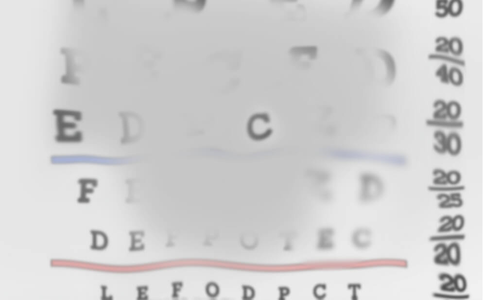 Image showing a blurry spot in the centre of the field of vision, demonstrating how GA may affect vision six years after diagnosis