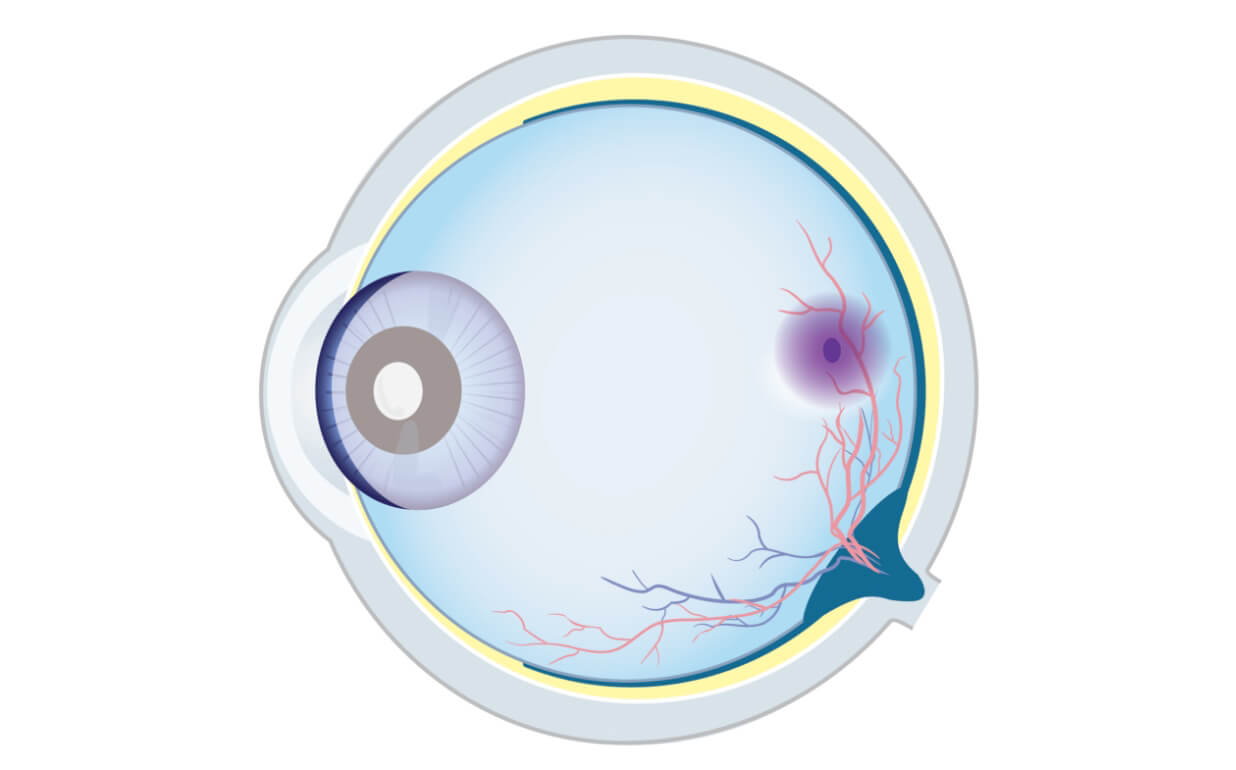 Diagram of a human eye