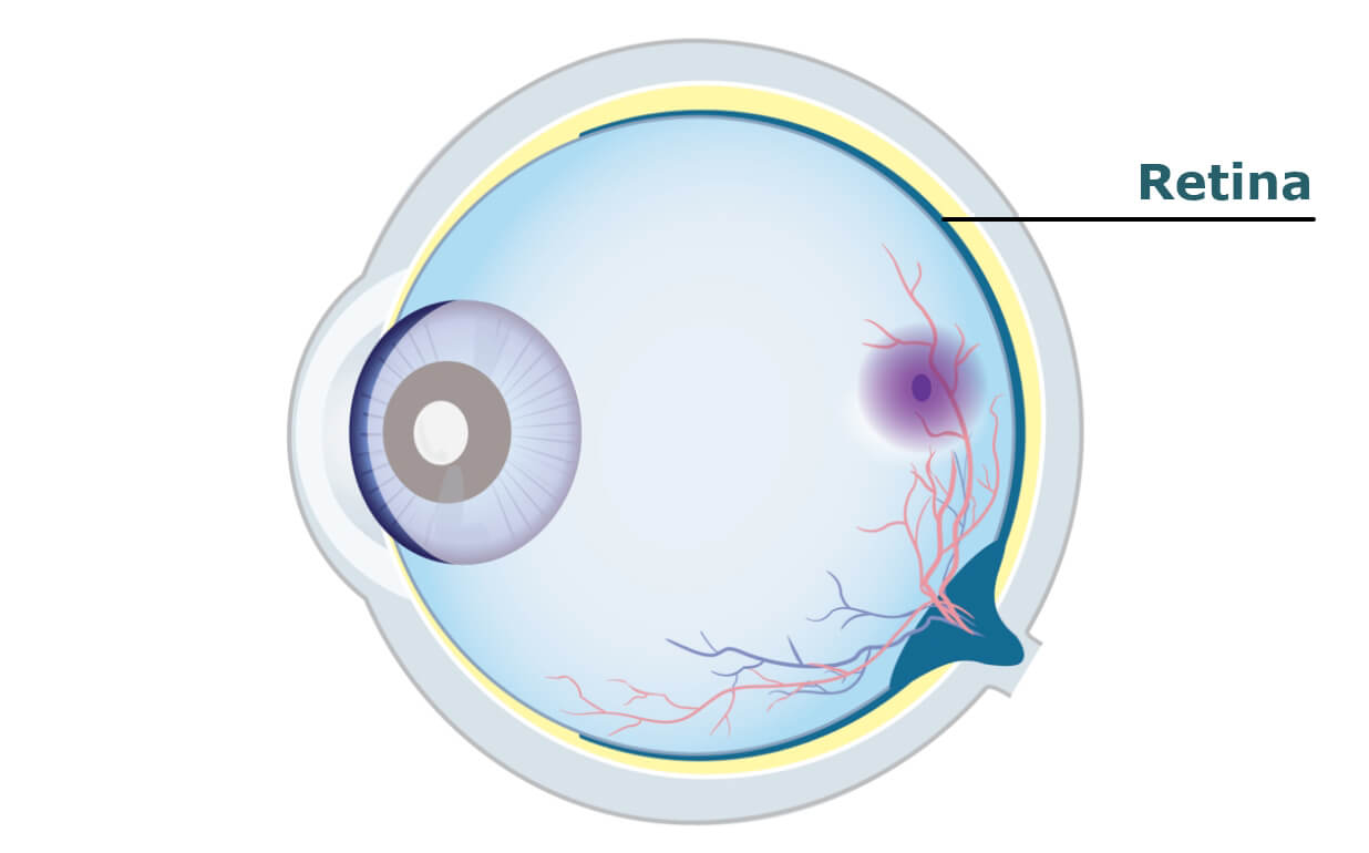 Diagram of a human eye with the retina labelled