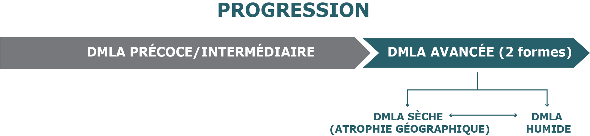 Diagramme de la progression de la DMLA du stade précoce au stade avancé